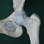 Πρόσθια προσπέλαση στην αρθροπλαστική ισχίου: τι είναι και ποια τα πλεονεκτήματα
